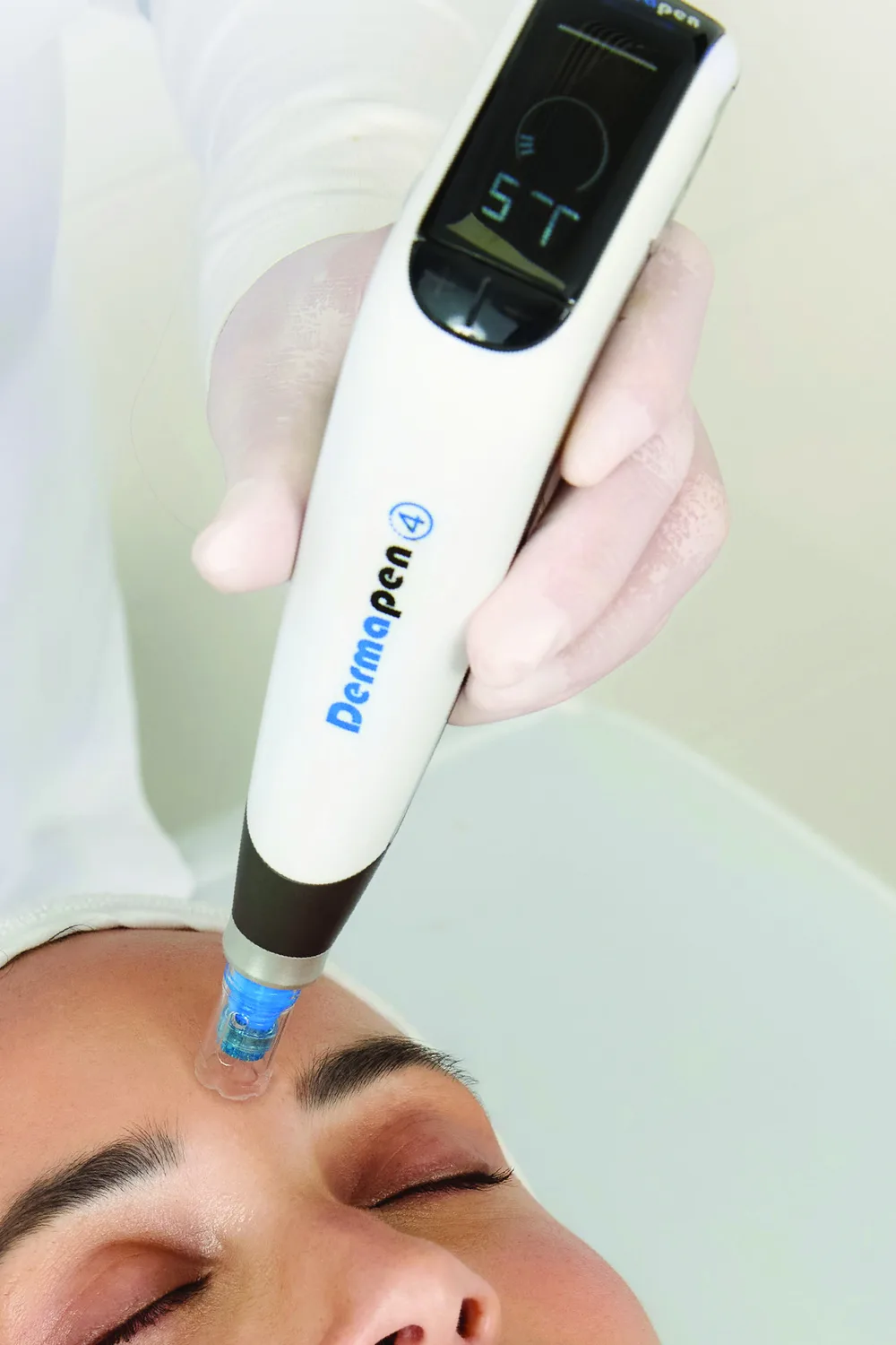 A clinician in gloves passing a Dermapen 4 microneedling device across a patient's forehead during treatment.