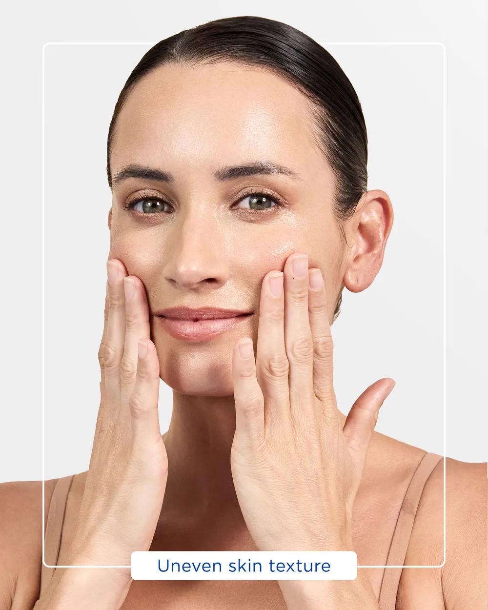A woman resting her fingertips on her cheeks, illustrating uneven skin texture, one of the concerns Dermapen 4 microneedling is used for.